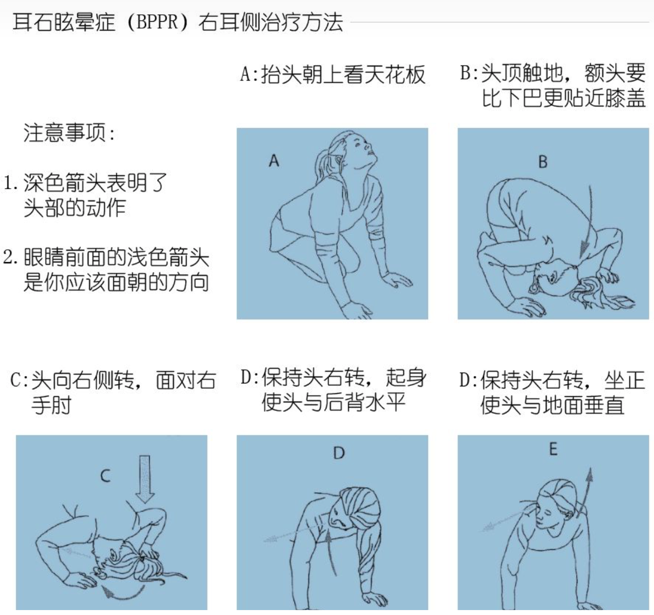 健康我来说｜耳石症能痊愈且不复发吗？