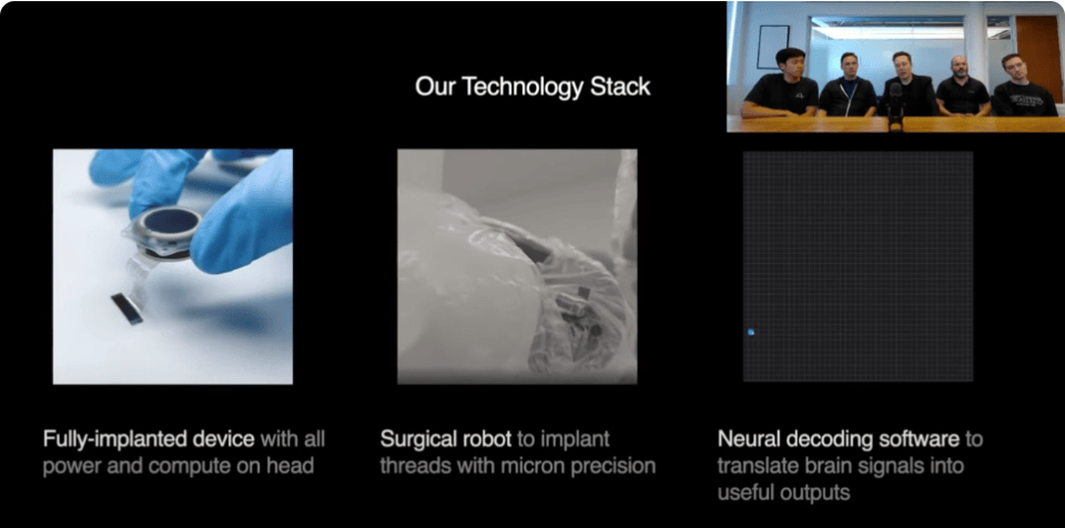 语言障碍患者通过脑机接口实现意念合成汉语