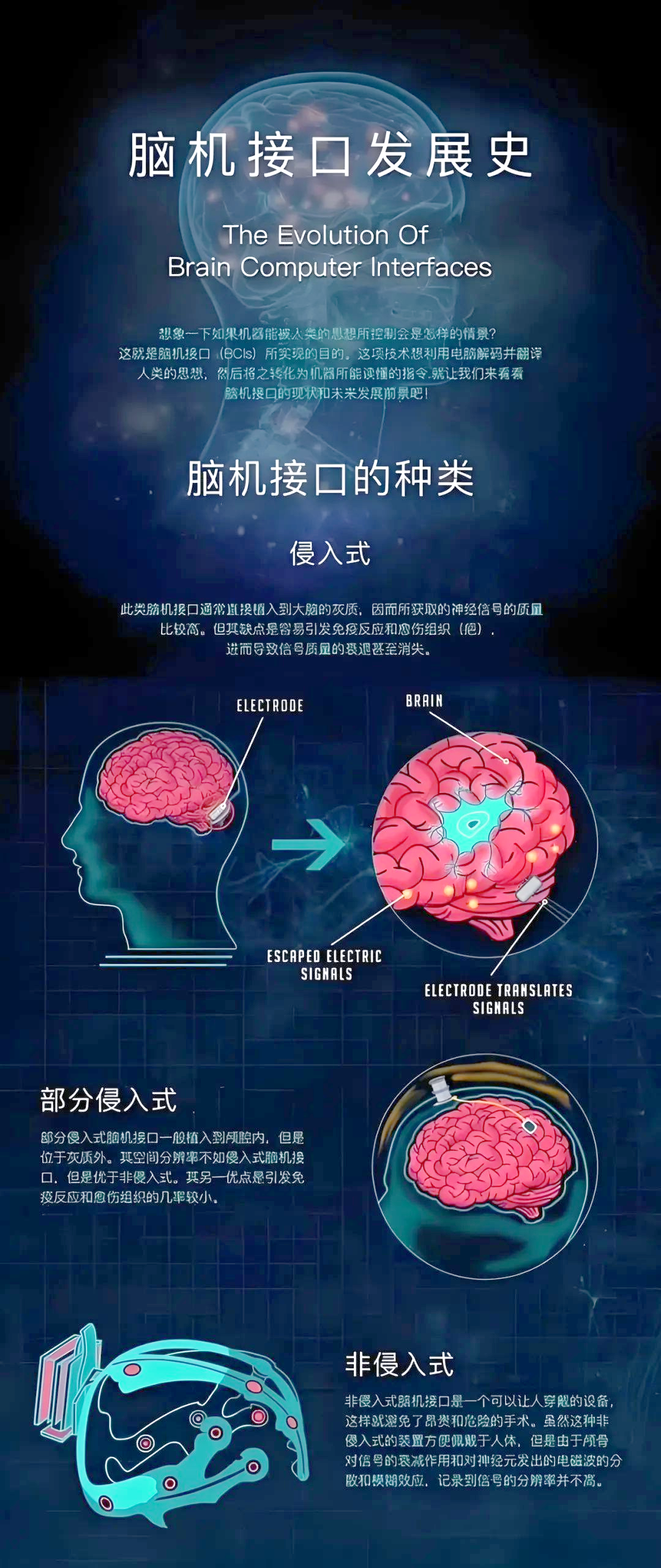 中国自研无线皮层脑机接口植入人脑通道数破世界纪录