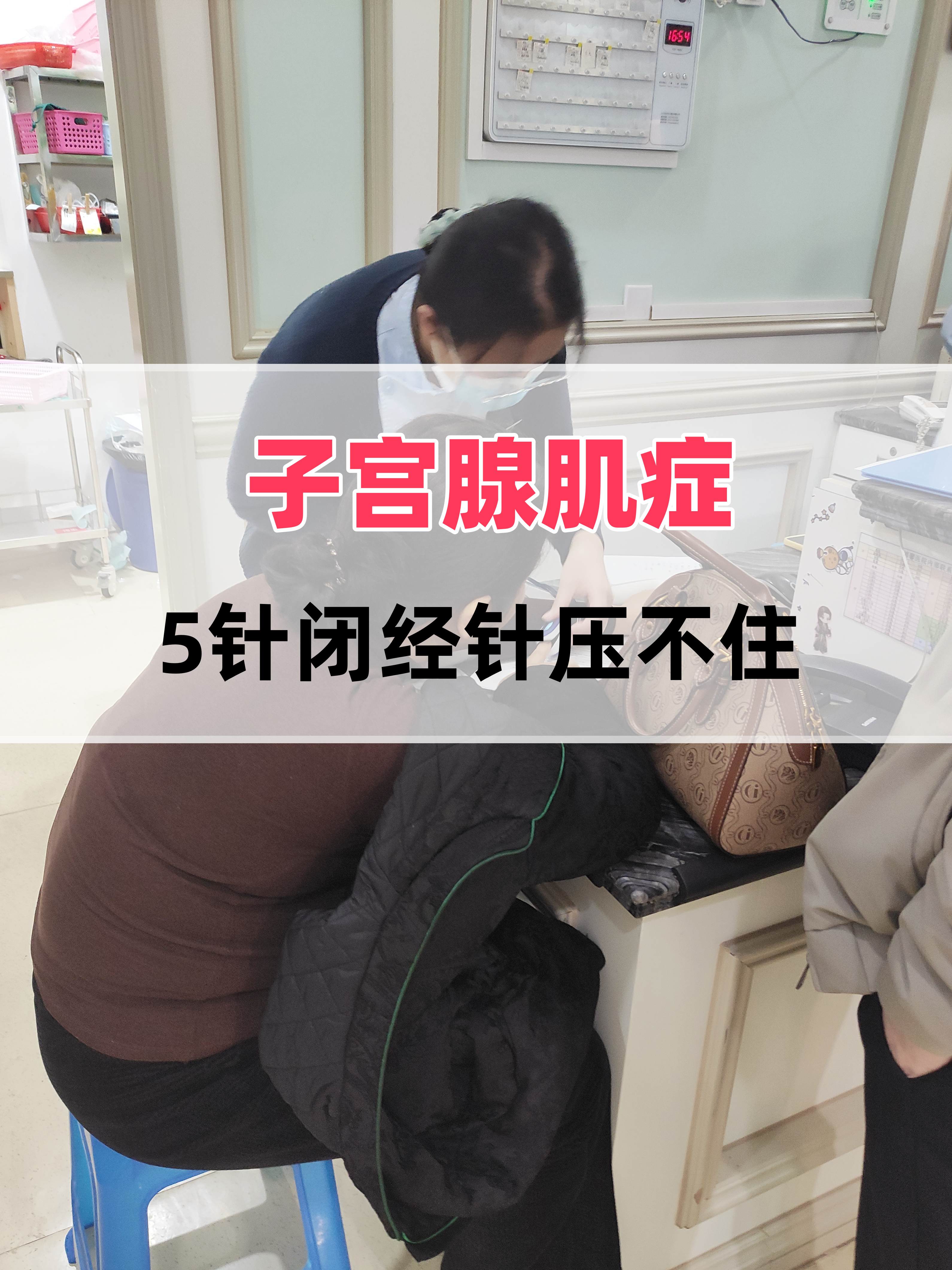 中国科学家找到治疗子宫腺肌症新靶点新方法